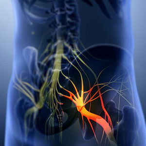 View the blog post for Back Pain with Sciatica during Lockdown